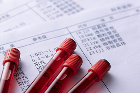 櫻桃簡(jiǎn)筆畫步驟4