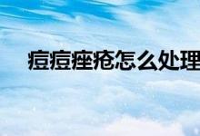 痘痘痤瘡怎么處理(臉上有痤瘡怎么辦)