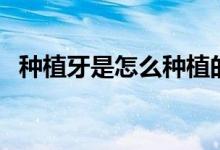 種植牙是怎么種植的（種植牙的種植步驟）