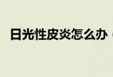 日光性皮炎怎么辦（有這樣兩種治療方法）