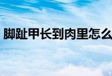 腳趾甲長到肉里怎么辦（按照以下方法解決）
