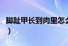 腳趾甲長到肉里怎么辦（需做好以下日常護理）