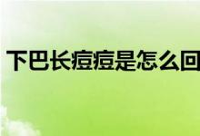下巴長痘痘是怎么回事（下巴長痘痘的原因）