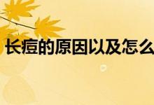 長痘的原因以及怎么祛痘（如何祛痘比較好）