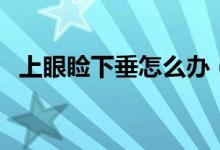 上眼瞼下垂怎么辦（怎么改善上眼瞼下垂）