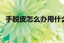 手脫皮怎么辦用什么藥膏（手脫皮怎么辦）