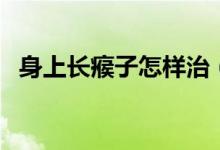 身上長瘊子怎樣治（身上長瘊子怎么消除）