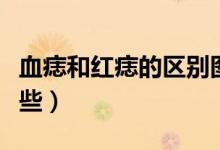 血痣和紅痣的區(qū)別圖（血痣和紅痣的區(qū)別有哪些）