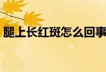 腿上長(zhǎng)紅斑怎么回事（腿上長(zhǎng)紅斑怎么回事）