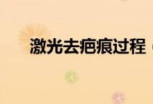 激光去疤痕過程（激光去疤痕多少錢）