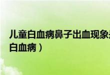 兒童白血病鼻子出血現(xiàn)象是怎樣的（寶寶鼻子出血是不是是白血?。?class=