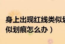 身上出現(xiàn)紅線類似劃痕圖片（身上出現(xiàn)紅線類似劃痕怎么辦）