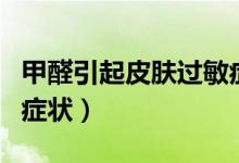 甲醛引起皮膚過敏癥狀（甲醛引起皮膚過敏的癥狀）