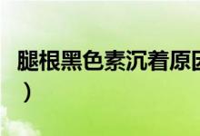 腿根黑色素沉著原因（腿根黑色素沉著怎么辦）