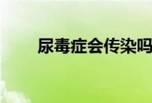 尿毒癥會傳染嗎（尿毒癥會傳染嗎）