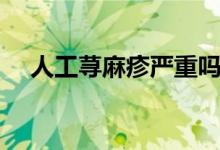 人工蕁麻疹嚴重嗎（人工蕁麻疹嚴重嗎）