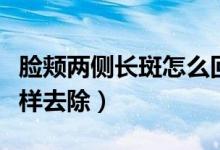 臉頰兩側(cè)長(zhǎng)斑怎么回事圖片（臉頰兩側(cè)長(zhǎng)斑怎樣去除）