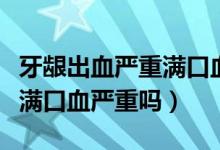 牙齦出血嚴重滿口血如何治療（牙齦出血嚴重滿口血嚴重嗎）