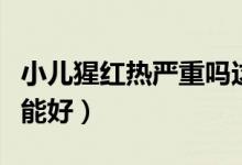 小兒猩紅熱嚴重嗎這種?。ㄐ盒杉t熱多少天能好）