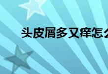 頭皮屑多又癢怎么辦（如何去屑止癢）
