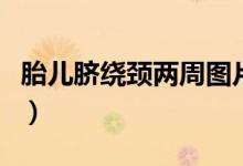 胎兒臍繞頸兩周圖片（胎兒臍繞頸兩周怎么辦）