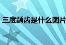 三度齲齒是什么圖片（三度齲齒是什么樣子）