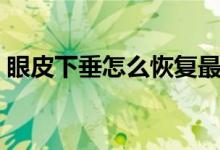 眼皮下垂怎么恢復(fù)最快（眼皮下垂怎么恢復(fù)）