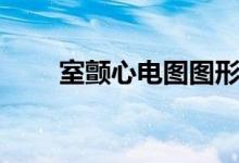 室顫心電圖圖形（室顫心電圖特點）