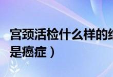 宮頸活檢什么樣的結(jié)果是癌癥（宮頸活檢幾點(diǎn)是癌癥）
