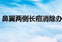 鼻翼兩側(cè)長(zhǎng)痘消除辦法（鼻翼長(zhǎng)痘怎么回事）