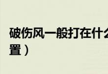 破傷風(fēng)一般打在什么位置（破傷風(fēng)是打哪個(gè)位置）