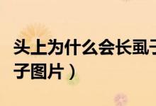 頭上為什么會長虱子視頻（頭上為什么會長虱子圖片）