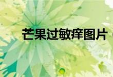 芒果過(guò)敏癢圖片（芒果過(guò)敏癢怎么辦）