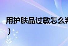 用護(hù)膚品過(guò)敏怎么判斷（用護(hù)膚品過(guò)敏怎么辦）