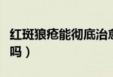紅斑狼瘡能徹底治愈嗎（紅斑狼瘡能徹底治愈嗎）