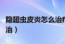 隱翅蟲皮炎怎么治療好得快（隱翅蟲皮炎怎么治）