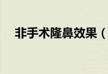 非手術(shù)隆鼻效果（非手術(shù)隆鼻效果好嗎）