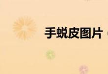手蛻皮圖片（手蛻皮怎么辦）