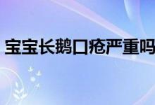寶寶長(zhǎng)鵝口瘡嚴(yán)重嗎（寶寶長(zhǎng)鵝口瘡怎么辦）