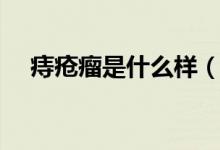 痔瘡瘤是什么樣（痔瘡瘤是什么樣子的）