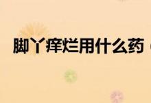 腳丫癢爛用什么藥（腳丫癢用什么藥最好）