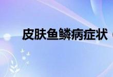 皮膚魚鱗病癥狀（魚鱗病有什么癥狀）