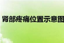 腎部疼痛位置示意圖（腎部疼痛是怎么回事）