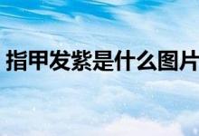 指甲發(fā)紫是什么圖片（指甲發(fā)紫是什么原因）