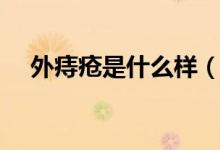 外痔瘡是什么樣（外痔瘡是什么樣子的）