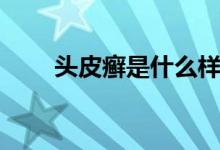 頭皮癬是什么樣的（頭皮癬是什么）