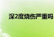 深2度燒傷嚴(yán)重嗎(深二度燒傷嚴(yán)重嗎)