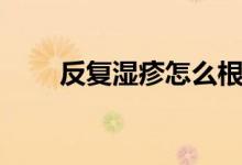 反復濕疹怎么根治（濕疹怎么根治）
