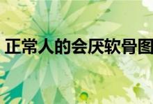 正常人的會厭軟骨圖（正常人的會厭部形態(tài)）