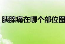 胰腺痛在哪個部位圖片（胰腺痛在哪個部位）